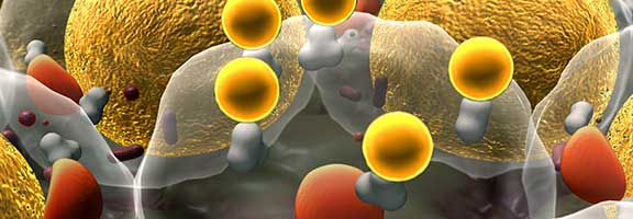 Oorzaken overgewicht